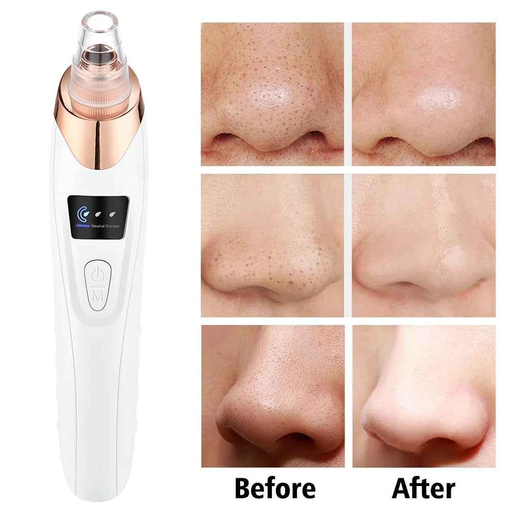 Electric Blackhead Remover, Vacuum Acne Cleaner, Black Spots Removal Device, Pore Cleaner Machine, Skin Care Tools, 5 Heads Suction Machine, Vacuum Electric Black Head Extractions Tool, Electric Facial Pore Cleaner, Exfoliating Beauty Device